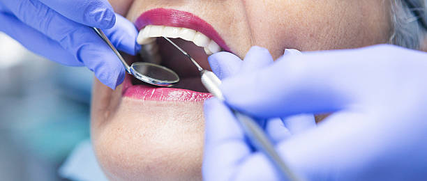 Best Urgent Care for Lost Fillings or Crowns in USA